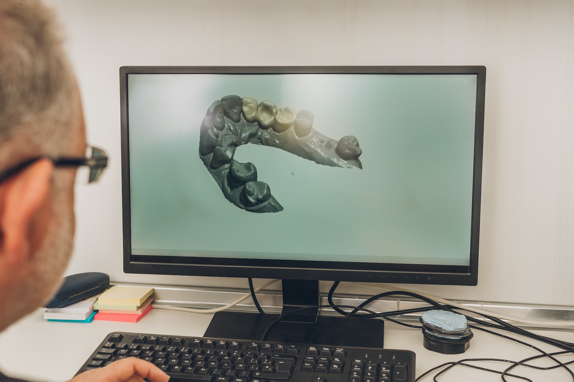 Man in front of a computer screen with a 3D image of a dental mould in dental laboratory