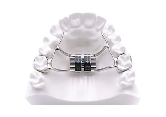 Rapid-palatal-expander