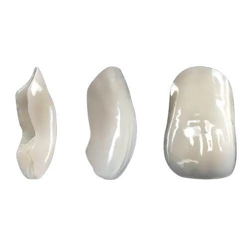 Zirconia Veneer