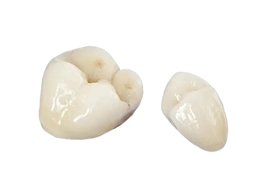 Porcelain Fused To Zirconia