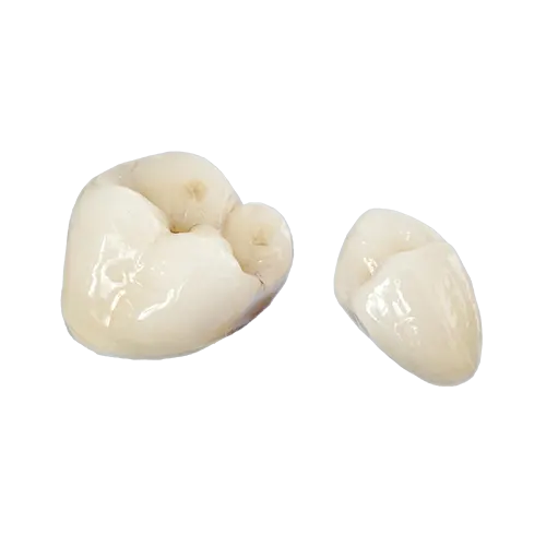 Porcelain Fused To Zirconia55