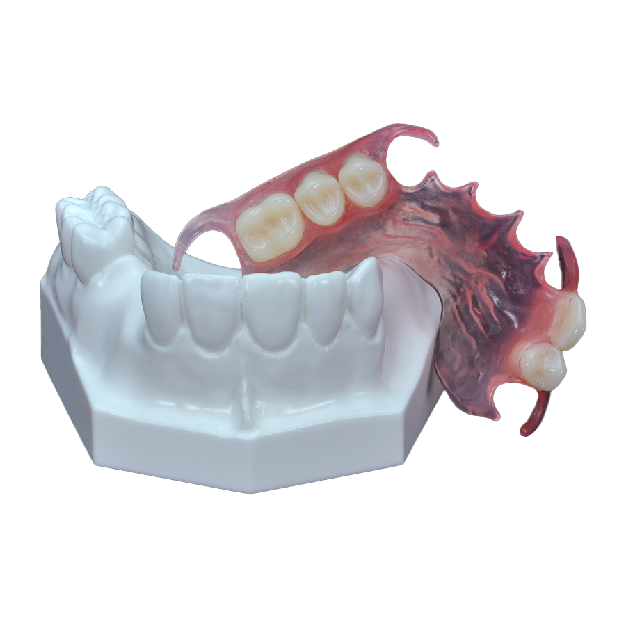 VALPLAST FLEXIBLE PARTIAL DENTURE