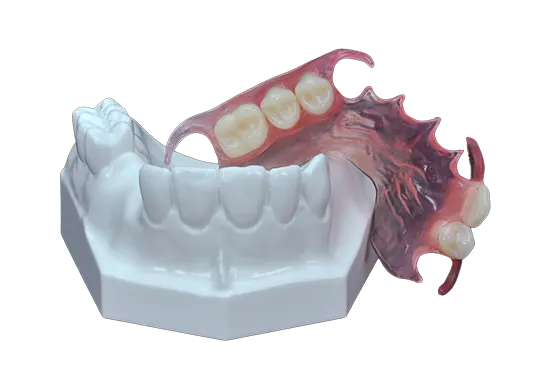 valplast flexible partial denture