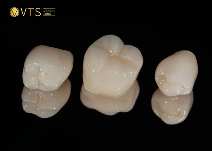 Zirconia Dental Bridge Cost 