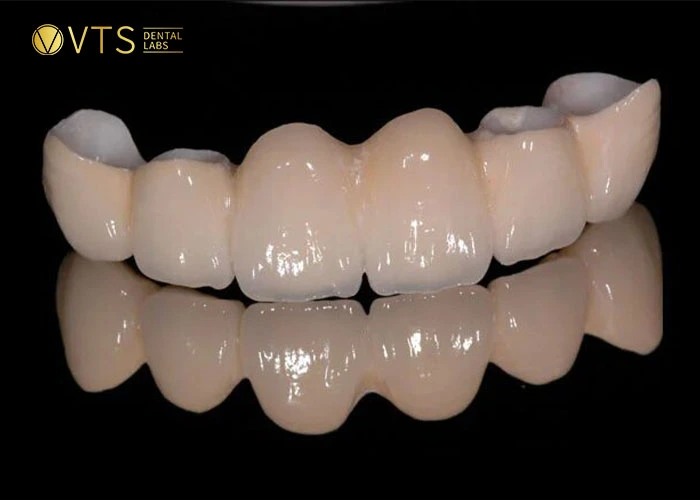 HT Zirconia has dental bridge costs higher