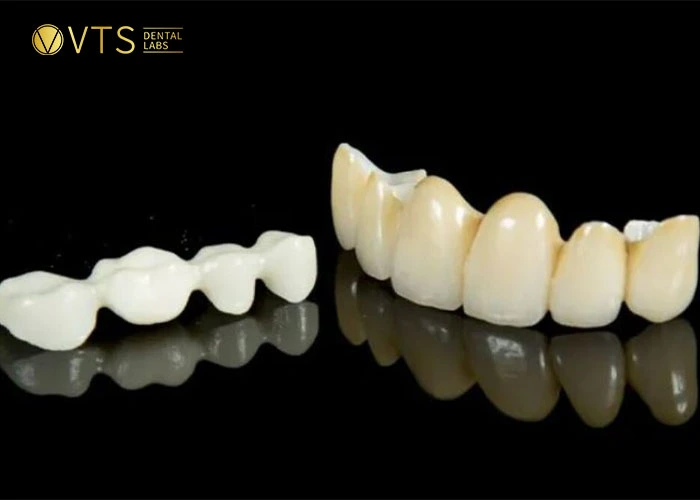 Layered Zirconia also has dental bridge cost more expensive than Full Zirconia.