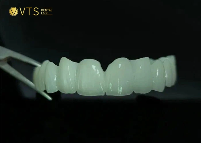 HT Zirconia: The ceramic bridge is considered