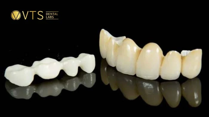 Full Zirconia: The popular ceramic bridge