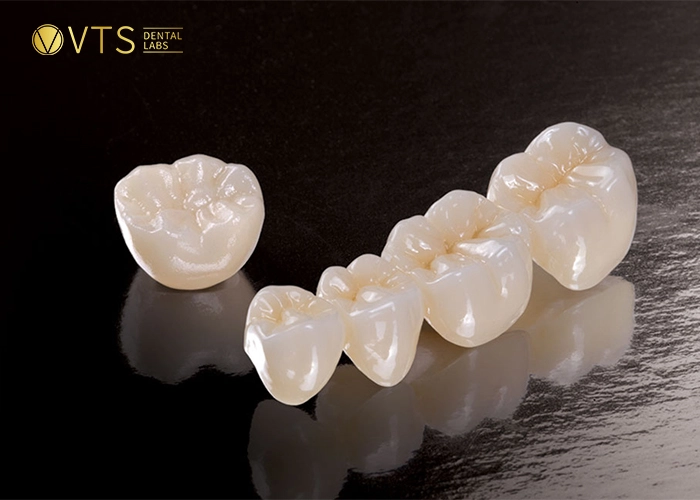 dental-crowns-and-bridges-3