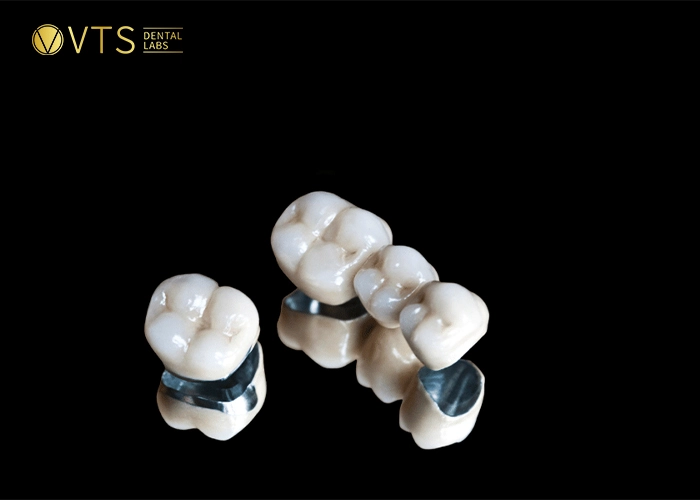 dental-crowns-and-bridges-4