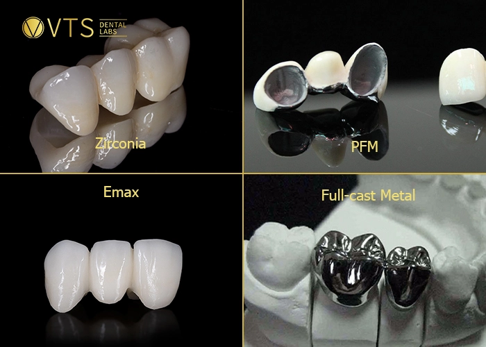 dental-crowns-in-sydney-2