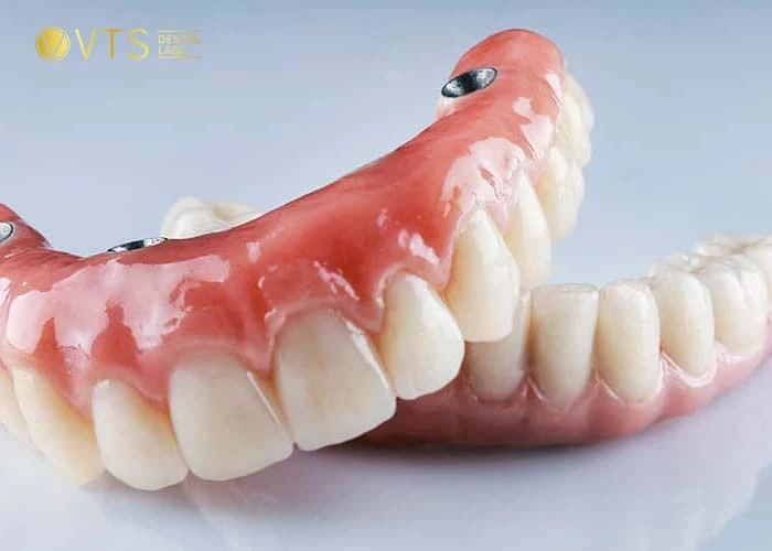 acrylic-denture-9