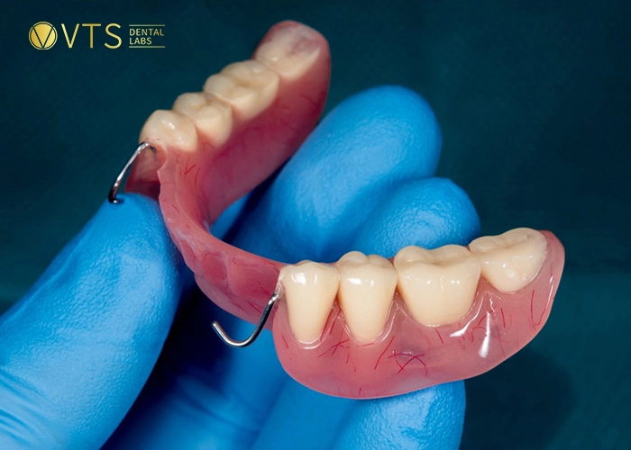 acrylic-partial-denture-2