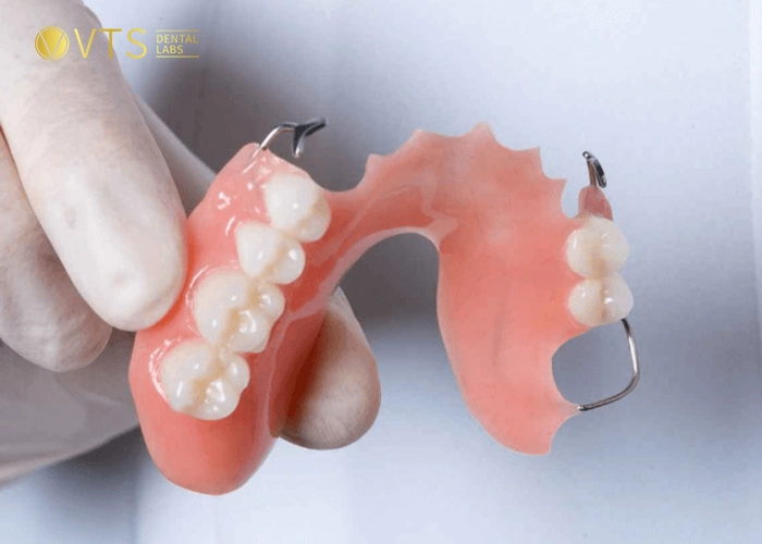 acrylic-partial-denture-3