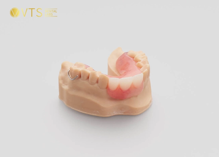 acrylic-partial-denture-6