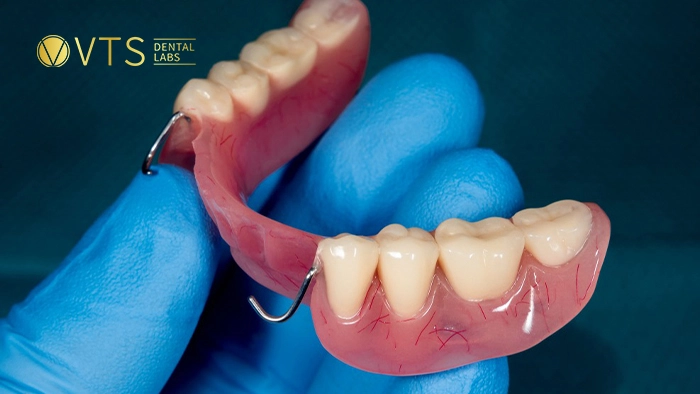 acrylic-partial-denture