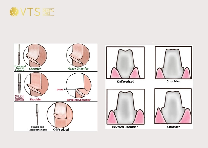 dental-crown-6