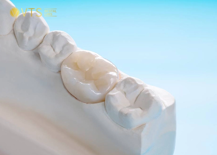 zirconia-crown-2