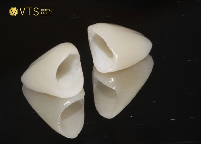 zirconia-crown-3