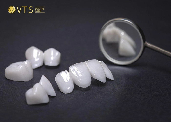 zirconia-crown-4