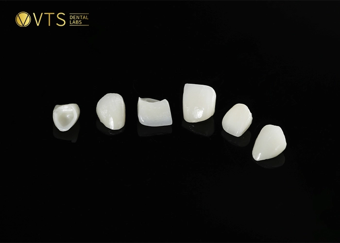 zirconia-crown-8