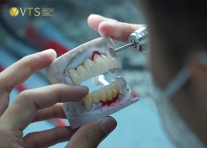 affordable-dentures-10