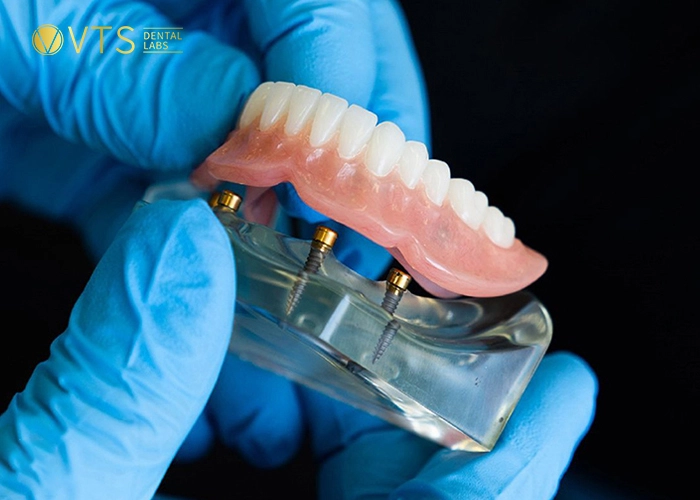 affordable-dentures-6