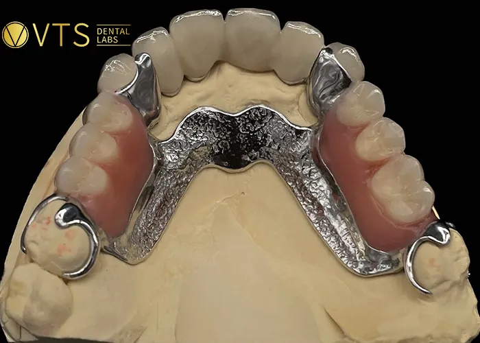 Chrome-Cobalt-Dentures-Durable-and-Aesthetic-Solution