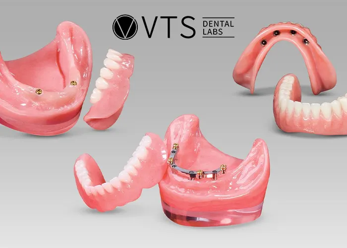 Denture-Costs-A-Comprehensive-Breakdown-for-Better-Decision-Making