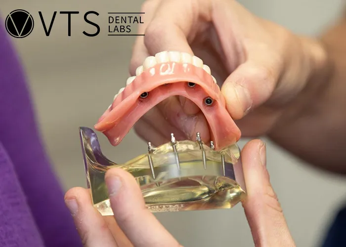 Denture-Costs-A-Comprehensive-Breakdown-for-Better-Decision-Making