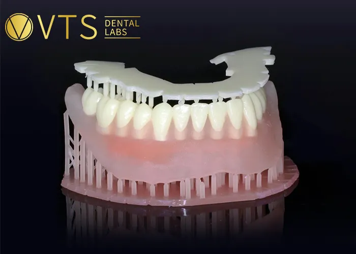Digital-Dentures-Explore-The-Ultimate-Process