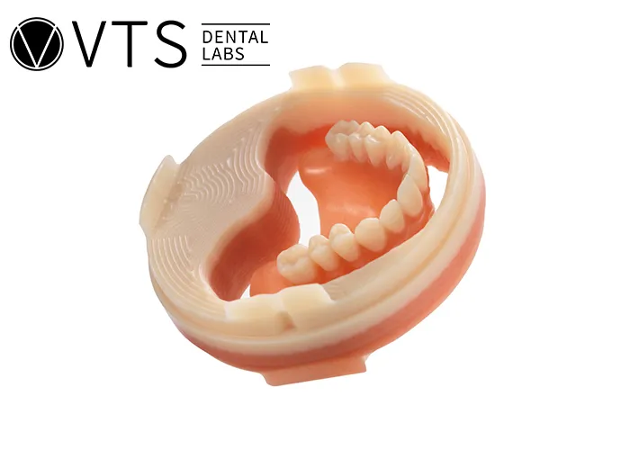 Digital-Dentures-Explore-The-Ultimate-Process