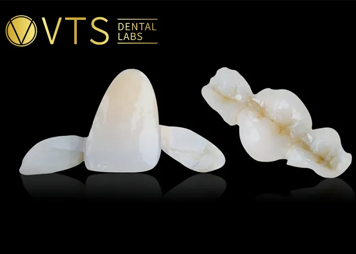 Fixed-Partial-Denture-Discover-The-Ultimate-Solution-For-Tooth-Loss