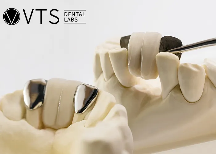 Fixed-Partial-Denture-Discover-The-Ultimate-Solution-For-Tooth-Loss