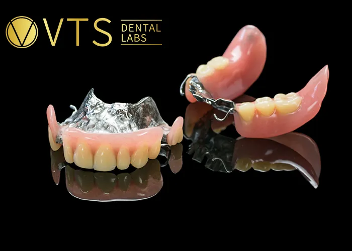 Fixed-Partial-Denture-Discover-The-Ultimate-Solution-For-Tooth-Loss