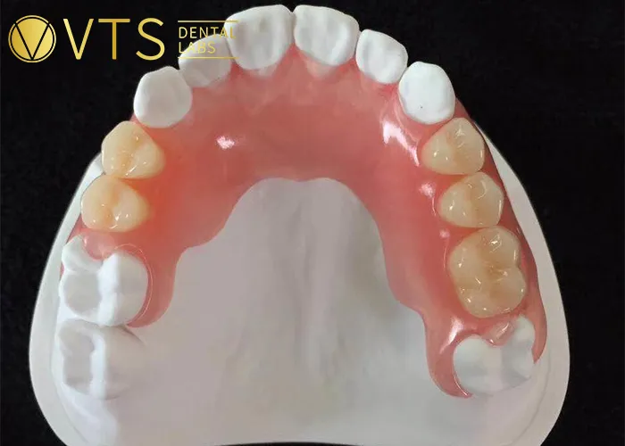 The-Undeniable-Advantages-of-Flexible-Dentures-in-Modern-Dentistry