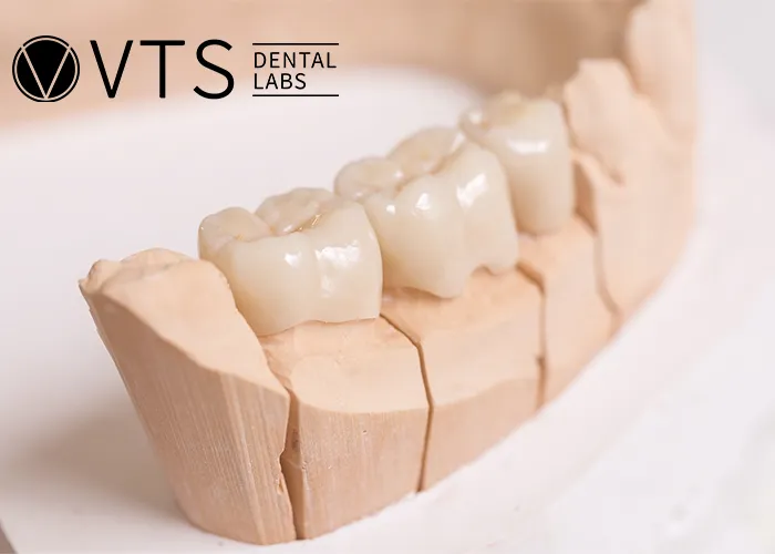 Flexible-Partial-Denture-vs.-Fixed-Which-One-Truly-Fits-Your-Needs?