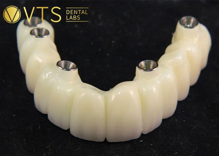 Flexible-Partial-Denture-vs.-Fixed-Which-One-Truly-Fits-Your-Needs?