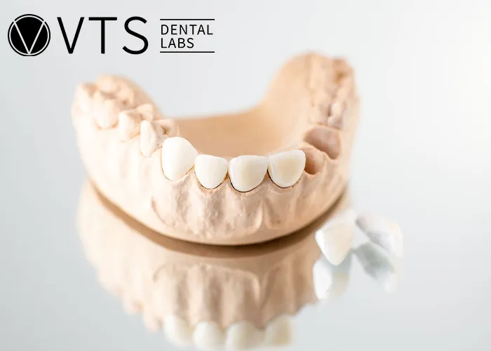 Flexible-Partial-Denture-vs.-Fixed-Which-One-Truly-Fits-Your-Needs?