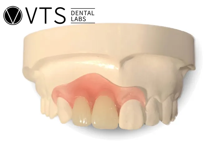 Flexible-Partial-Denture-vs.-Fixed-Which-One-Truly-Fits-Your-Needs?