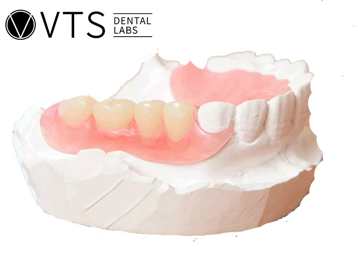 Flexible-Partial-Denture-vs.-Fixed-Which-One-Truly-Fits-Your-Needs?