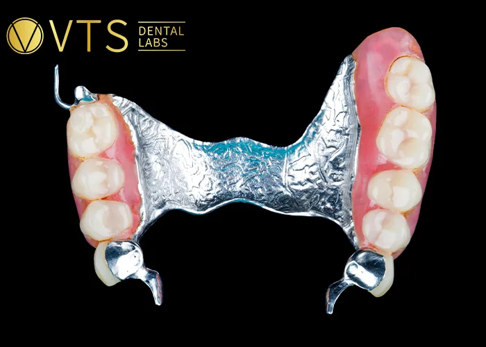Acrylic-vs-Metal-Partial-Dentures-Discover-the-Best-Choice-for-Patients