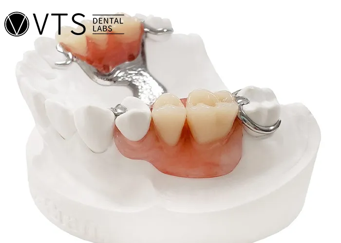 Acrylic-vs-Metal-Partial-Dentures-Discover-the-Best-Choice-for-Patients