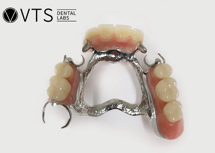 Acrylic-vs-Metal-Partial-Dentures-Discover-the-Best-Choice-for-Patients
