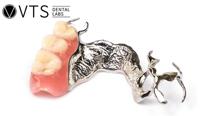 Acrylic-vs-Metal-Partial-Dentures-Discover-the-Best-Choice-for-Patients