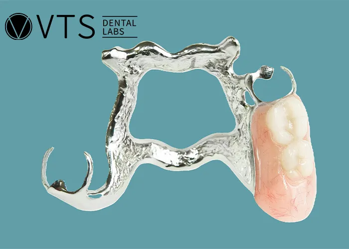 Acrylic-vs-Metal-Partial-Dentures-Discover-the-Best-Choice-for-Patients