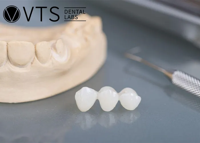 One-Tooth-Denture -The-Optimal-Solution-for-Dentists-and-Patients