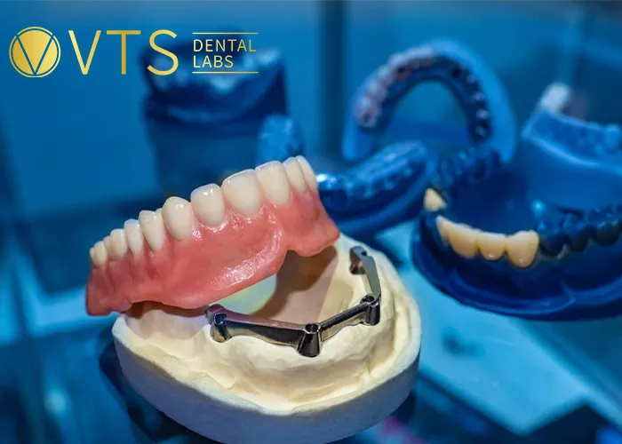 One-Tooth-Denture -The-Optimal-Solution-for-Dentists-and-Patients