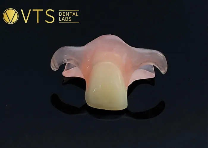 One-Tooth-Denture -The-Optimal-Solution-for-Dentists-and-Patients