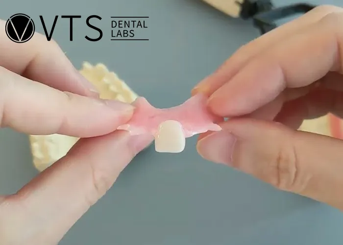 One-Tooth-Denture -The-Optimal-Solution-for-Dentists-and-Patients